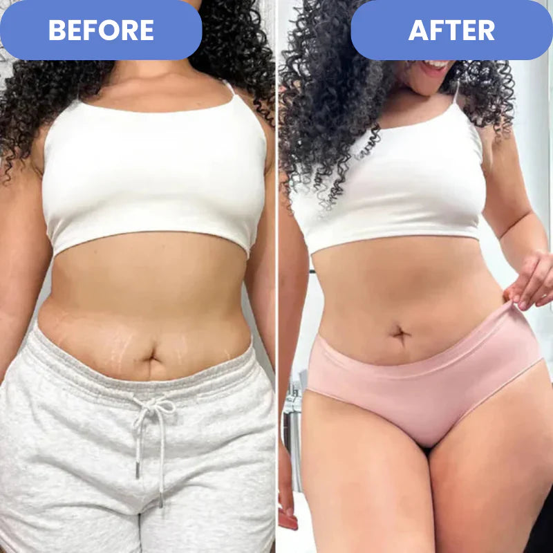 ProSculpt™ - Cellulite Treatment 4-in-1 -EBOOK GRATUITO