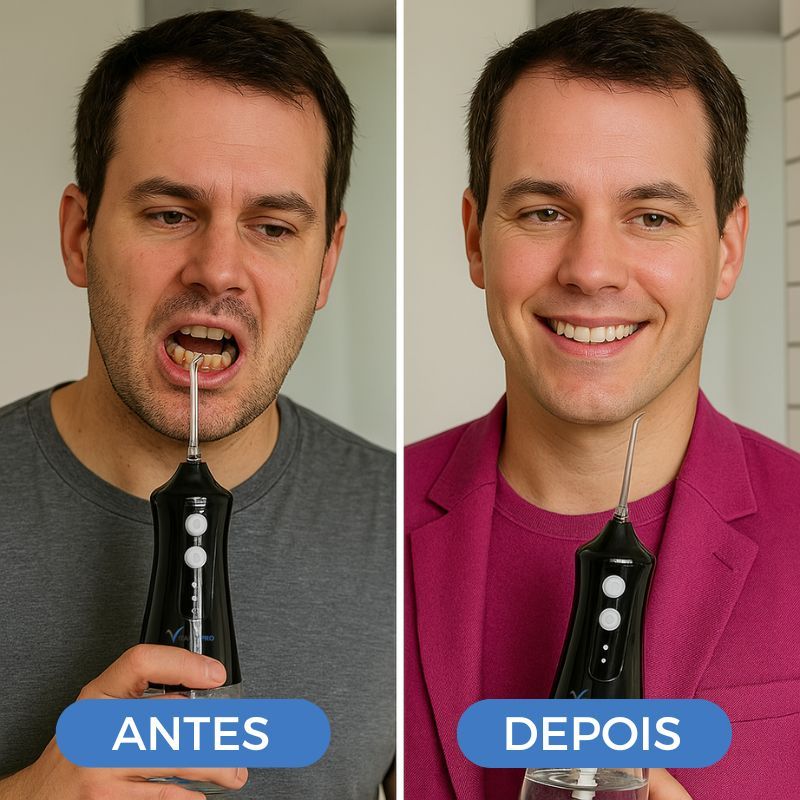 VitallyPRO-Irrigador bucal supersónico para una limpieza profunda con chorro de agua
