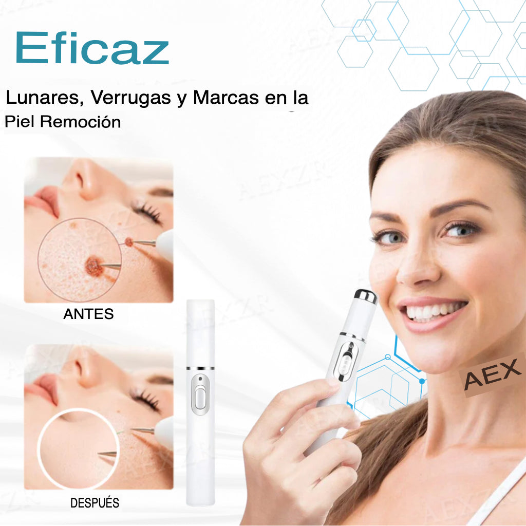 NeoLaser™- Láser no invasivo para eliminar lunares y verrugas