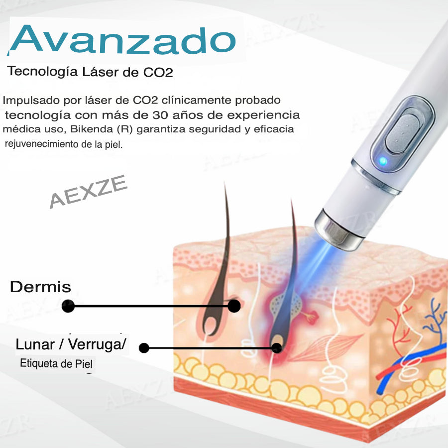 NeoLaser™- Láser no invasivo para eliminar lunares y verrugas