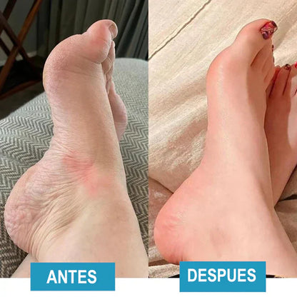 FootTherapy- ¡la revolución para sus pies!