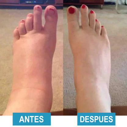 FootTherapy- ¡la revolución para sus pies!